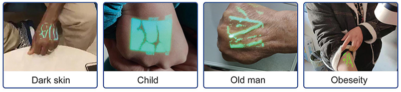 vein finder application